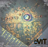 eVIT MS измерение площади.jpg